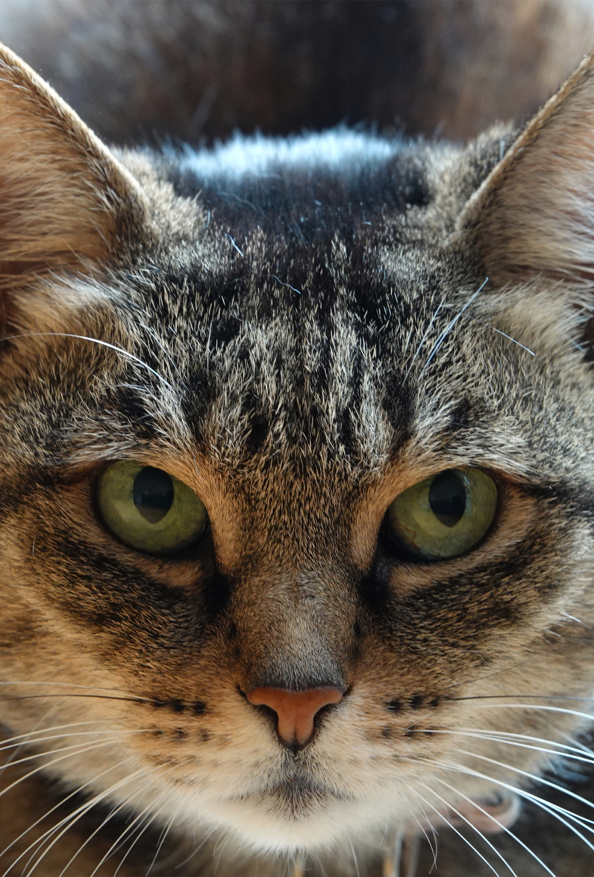 Eriyen kornea ülseri: Keratomalazi