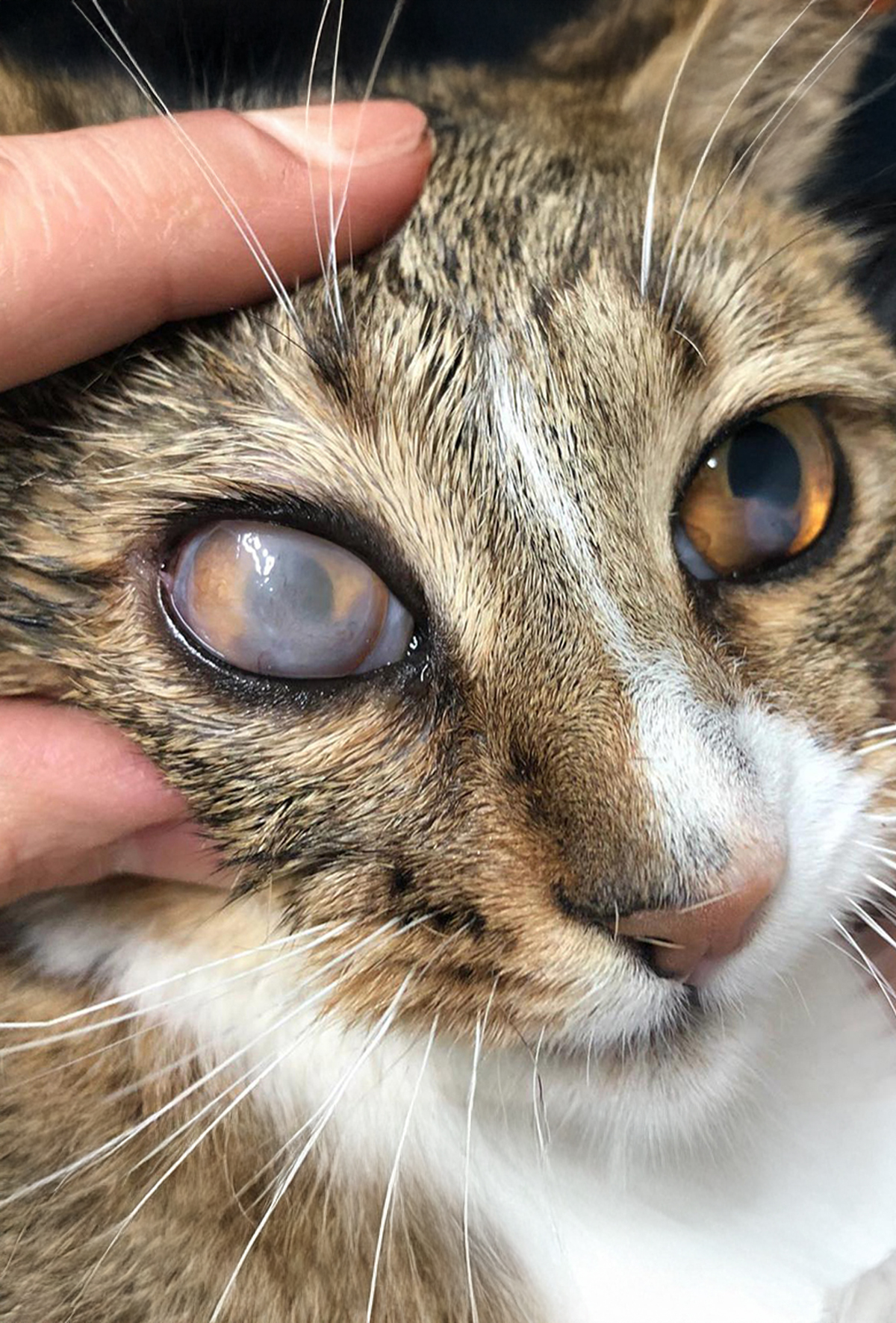 Simblefaron: Tanımı, etiyolojisi, klinik bulguları ve yönetimi