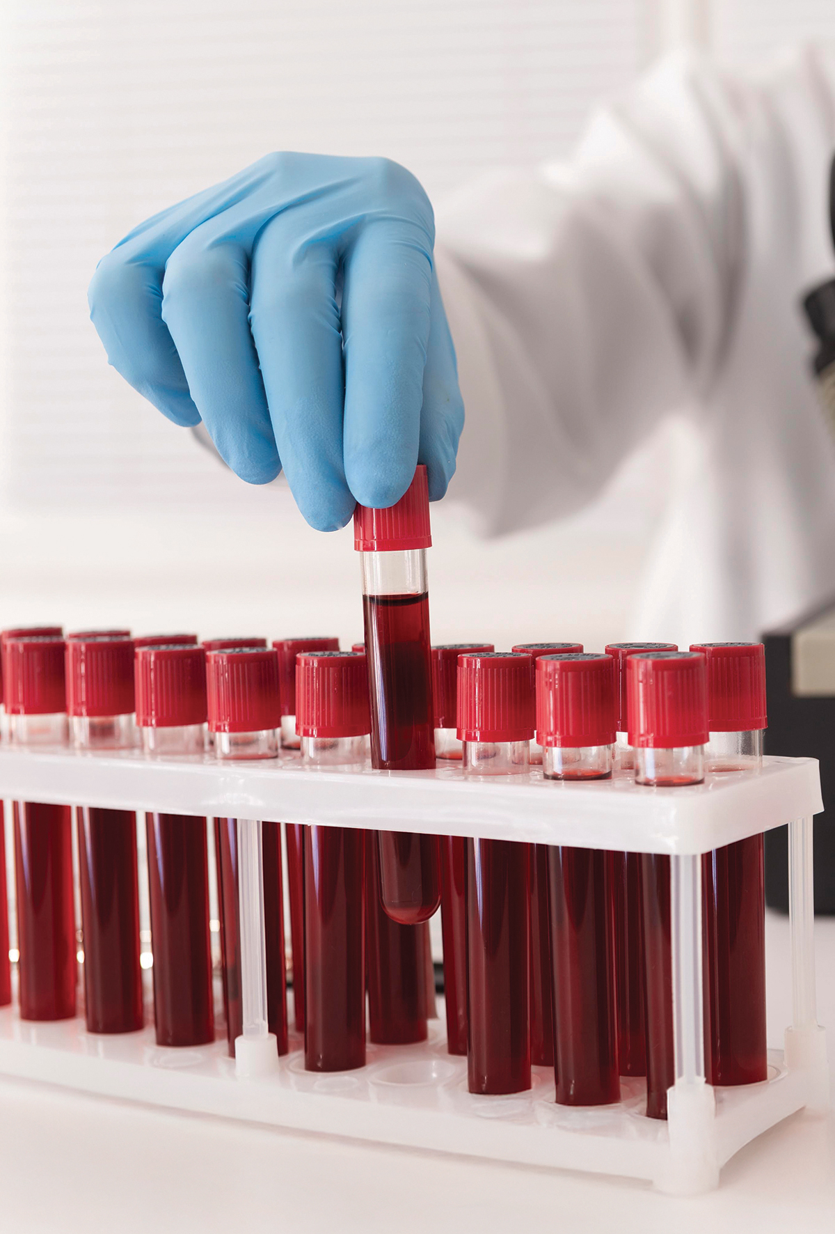 Kedi kronik ağrı tespitinde yeni biyobelirteç: Felinin